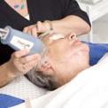 laser mole removal.jpg